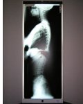 Chiro 1Bay VB