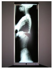 Chiropractic 1 Bay Viewing Box